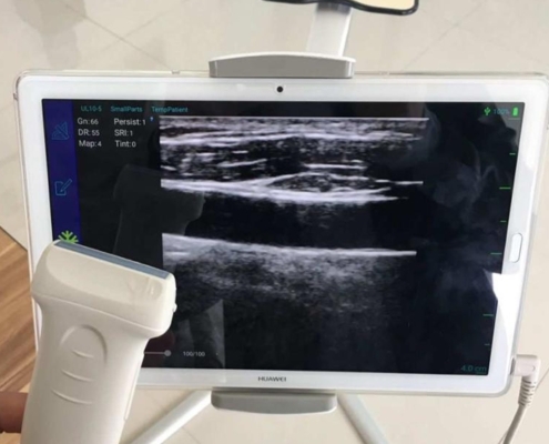 Mobile USB veterinary ultrasound probes for sale PM-V4U (1)