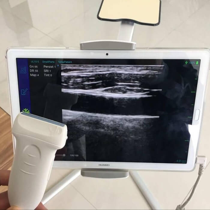 Mobile USB veterinary ultrasound probes for sale PM V4U 1 - Fish Ultrasound