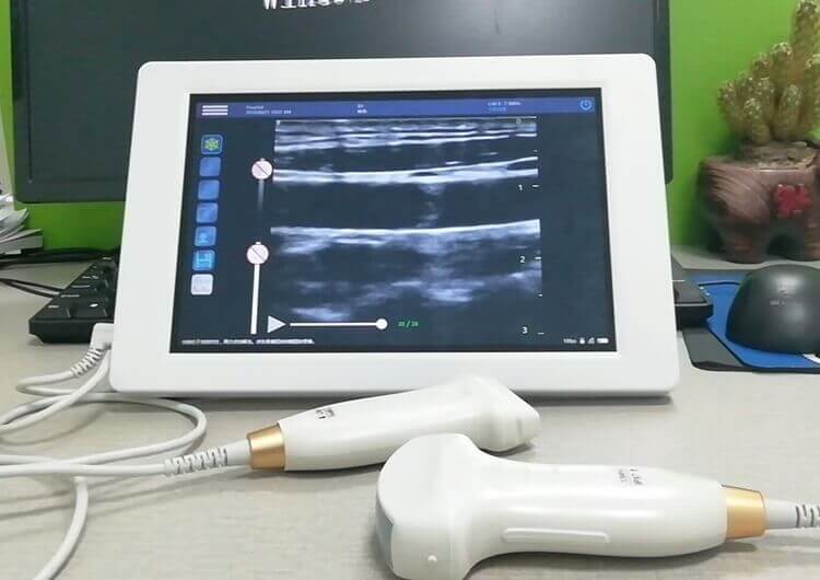 Mobile USB veterinary ultrasound probes - Home
