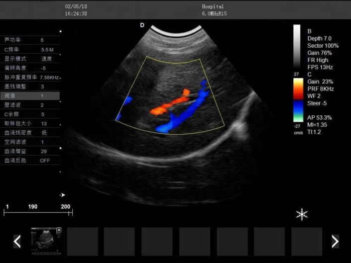 Trolley Doppler Liver Veterinary Ultrasound Machine PM-V5T 49