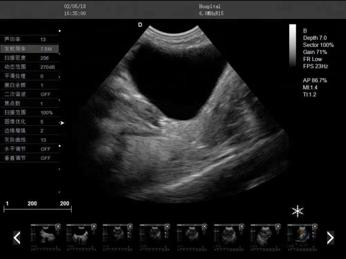 Trolley doppler liver veterinary ultrasound machine PM V5T 23 705x529 - Trolley Doppler Liver Veterinary Ultrasound Machine PM-V5T