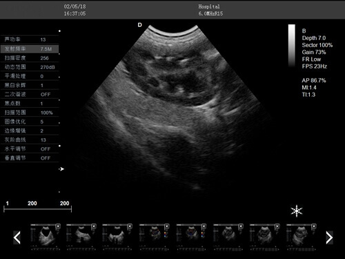 Trolley doppler liver veterinary ultrasound machine PM V5T 4 - Trolley Doppler Liver Veterinary Ultrasound Machine PM-V5T
