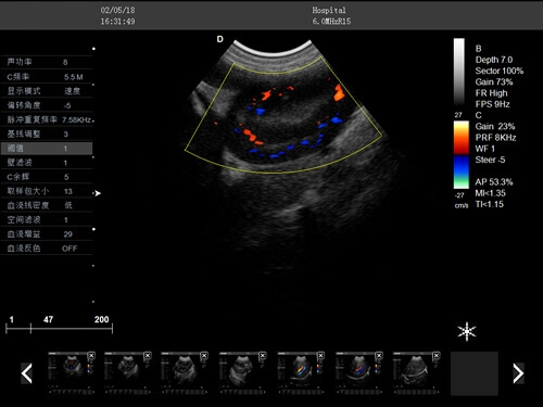 Trolley doppler liver veterinary ultrasound machine PM V5T 6 - Trolley Doppler Liver Veterinary Ultrasound Machine PM-V5T