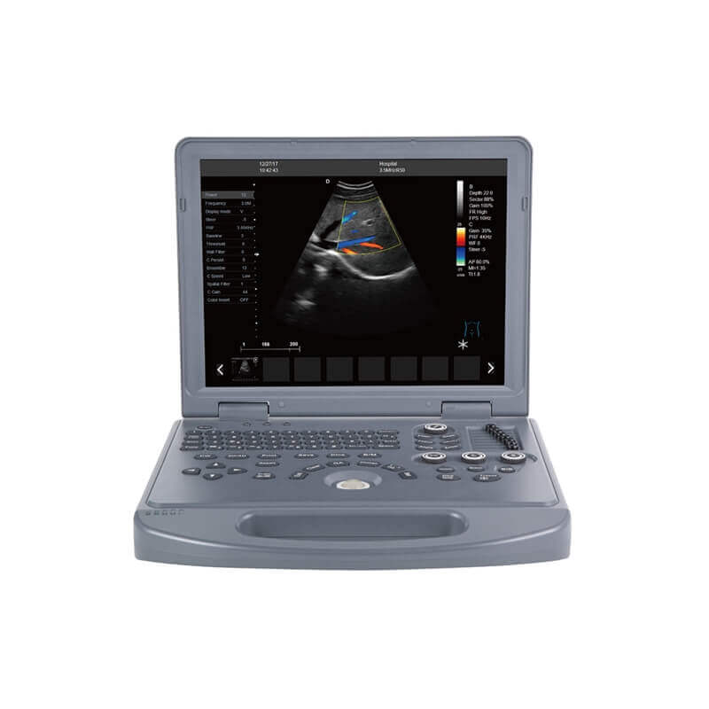 portable color doppler portable animal ultrasound machine PM V3P 1 - Portable Pet Small Animal Ultrasound Machine PM-V3P