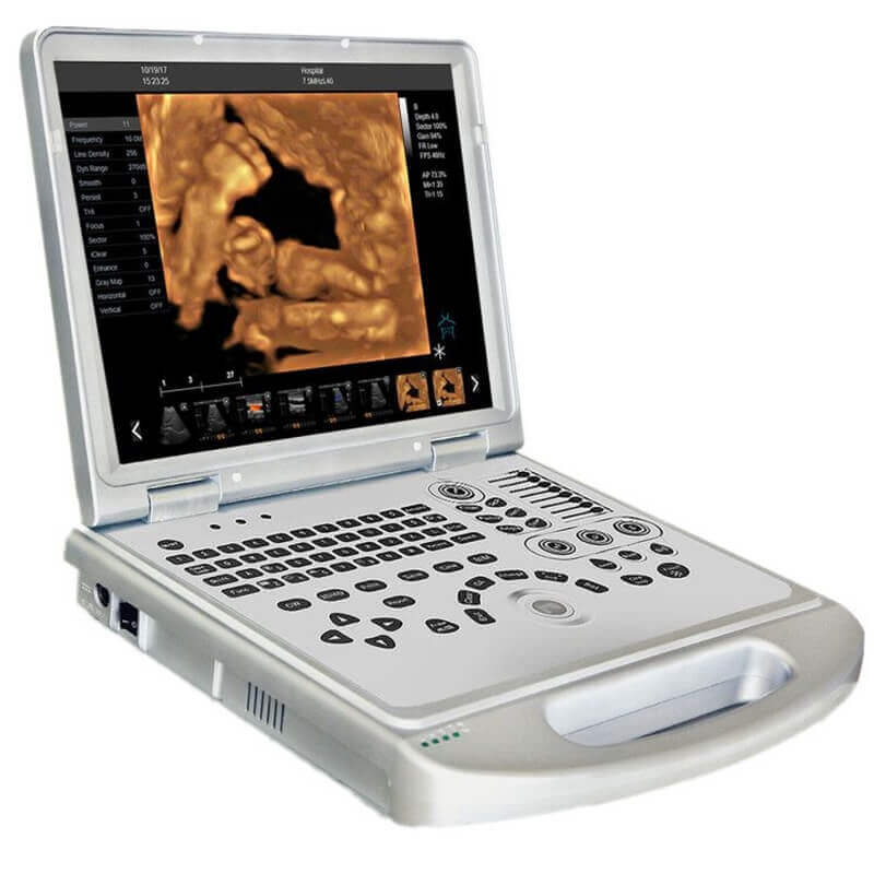 portable ultrasound machine for veterinary animal PM V5P 5 1 - Portable Ultrasound Machine for Veterinary Animal PM-V5P