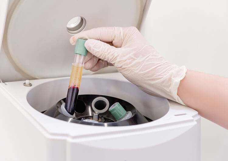 Blood Serum Centrifuge for Separating Cells From Plasma - Products-Veterinary medical equipment