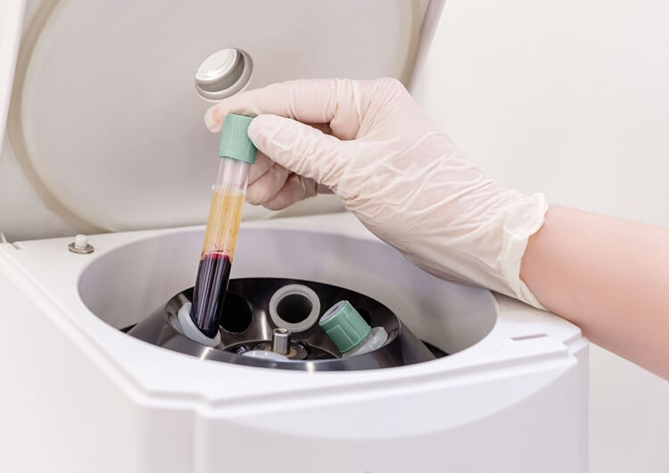 Blood Serum Centrifuge for Separating Cells From Plasma - Centrifuge