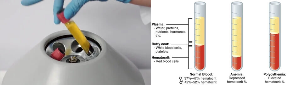 Centrifuged blood 1 - Serum Centrifuge