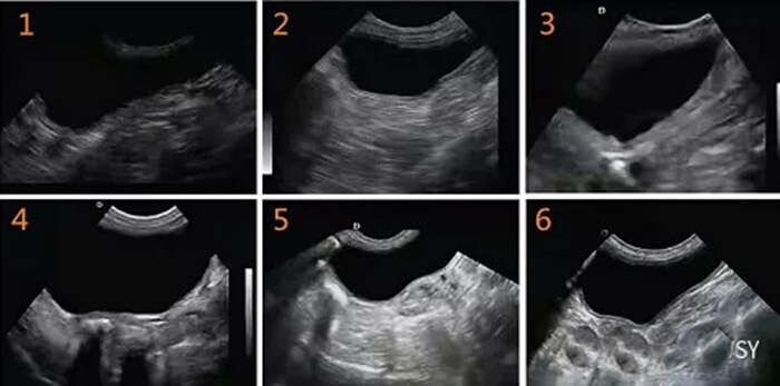 How To Check the Pet Bladder Clot Through the Pet Ultrasound 3 - Pet Ultrasound