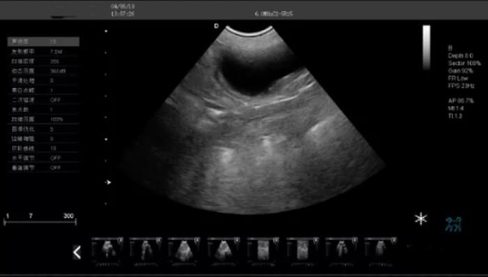 How To Check the Pet Bladder Clot Through the Pet Ultrasound 4 - Pet Ultrasound