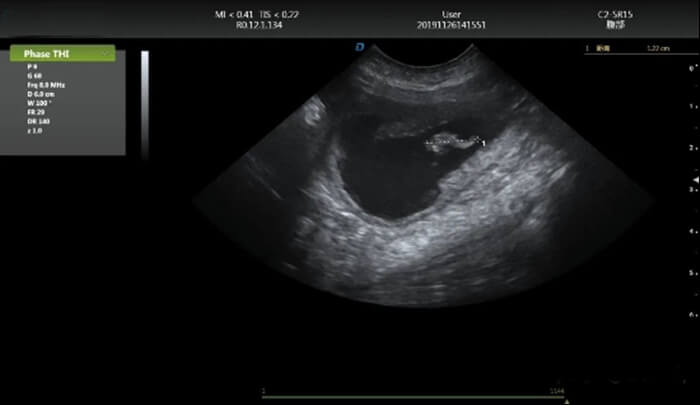 How To Check the Pet Bladder Clot Through the Pet Ultrasound 5 - Pet Ultrasound