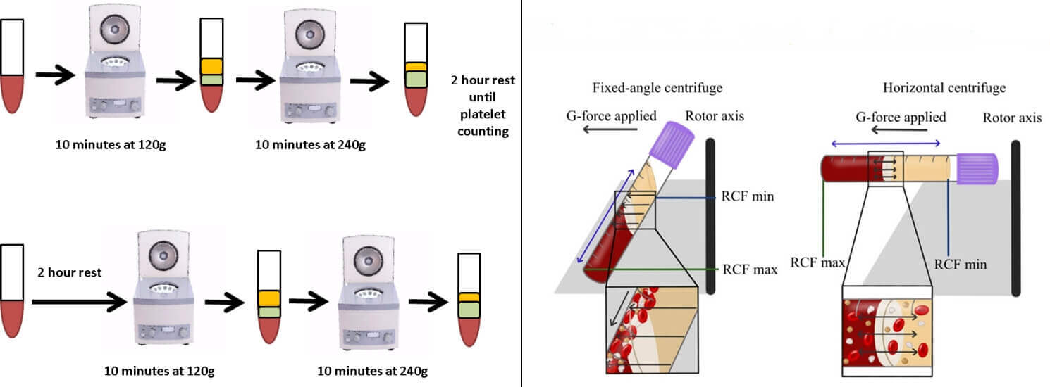 PRP Centrifuge Speed and Time - PRP Centrifuge