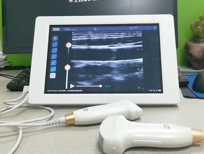 Veterinary Mobile Ultrasound machine - Veterinary Mobile Ultrasound