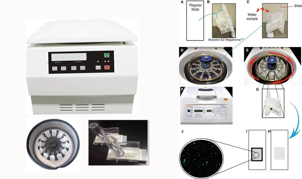 Cytospin Centrifuge - Different Types of Centrifuges, Functions, Uses and Prices, How to Choose?