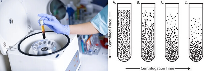 Different Types of Centrifuges, Functions, Uses and Prices, How to Choose? 2