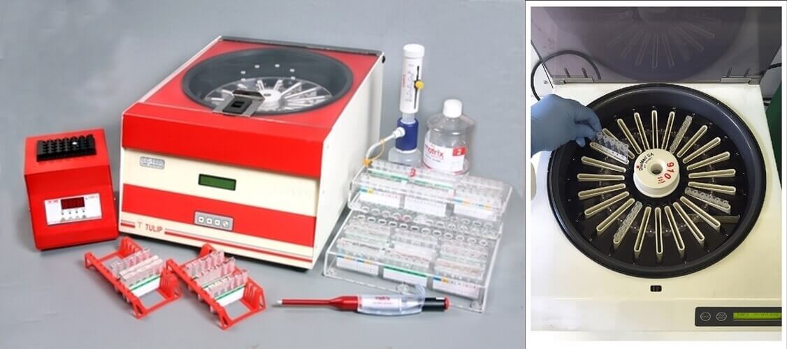Gel Card Centrifuge - Different Types of Centrifuges, Functions, Uses and Prices, How to Choose?