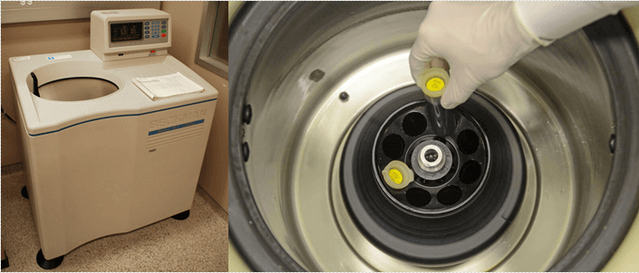 Ultracentrifugation  - Different Types of Centrifuges, Functions, Uses and Prices, How to Choose?