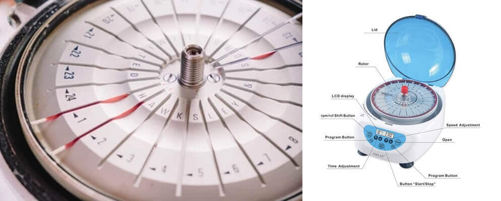 What Is A Hematocrit Centrifuge - Different Types of Centrifuges, Functions, Uses and Prices, How to Choose?