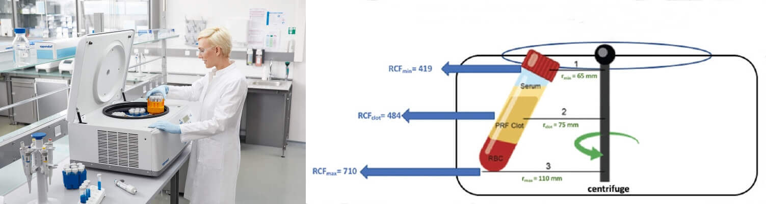 Refrigerated centrifuge principle - Refrigerated Centrifuge